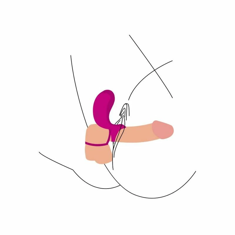 PIERÅšCIENIE EREKCYJNE