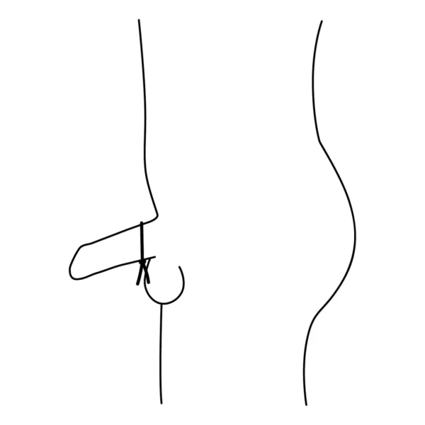 eroticshop