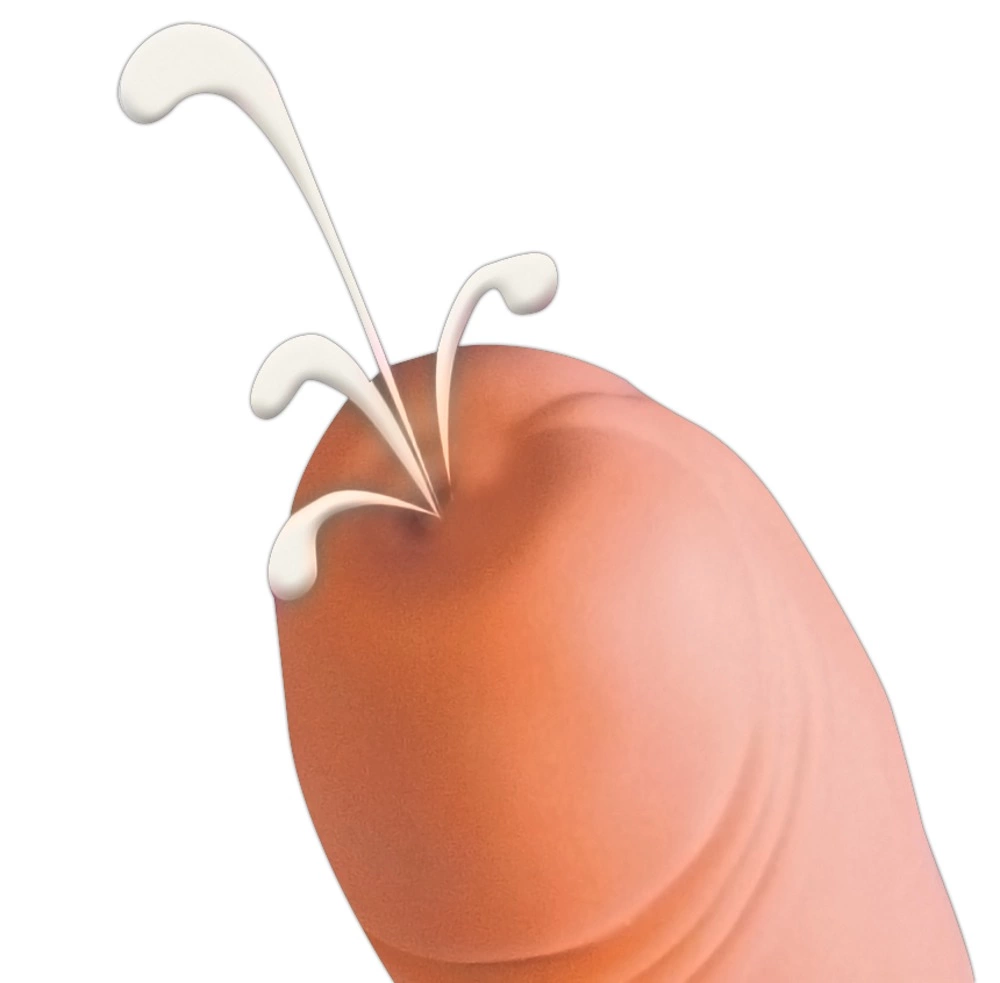 erotiikkaliike